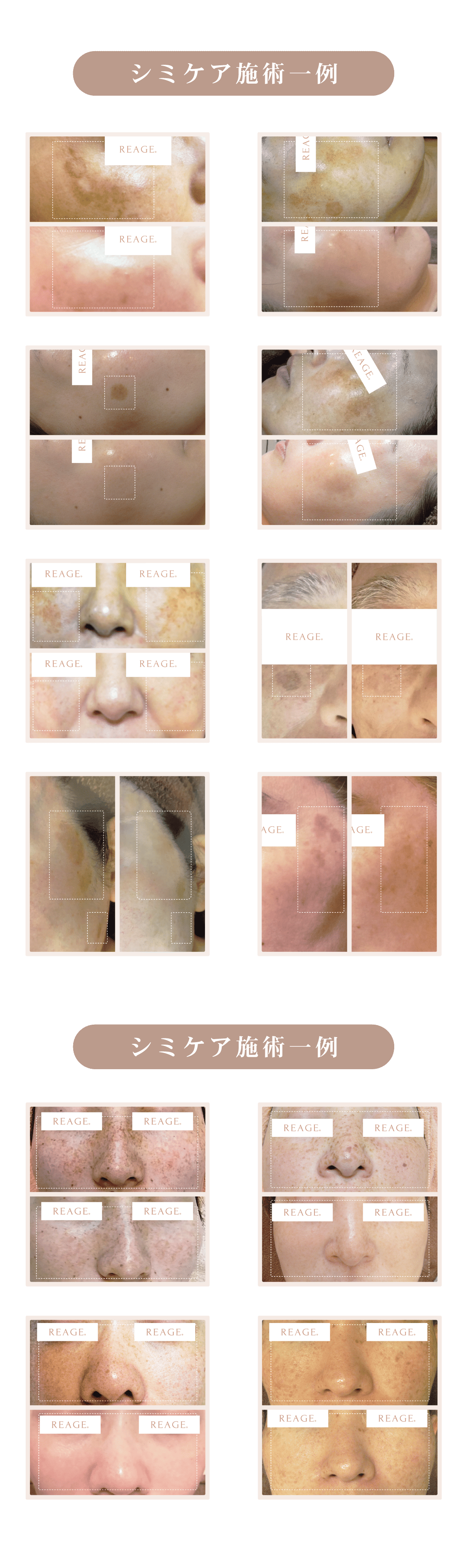 REAGE施術一覧